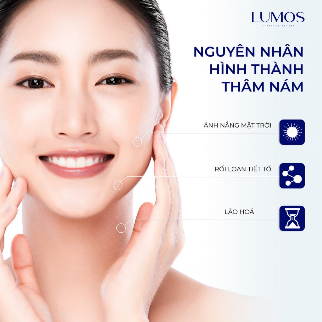 Nám Da Là Gì? Nguyên Nhân Hình Thành Nám Da Bạn Nên Biết