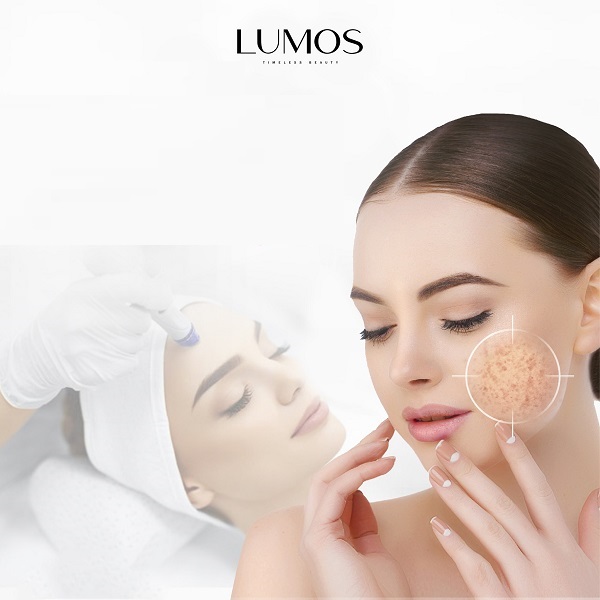 Lumos Beauty L&M 2 cam kết được sản xuất từ thành phiền thiên nhiên lành tính, an toàn 